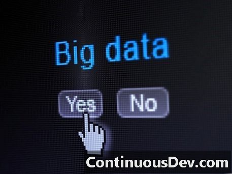 7 Dinge, die Sie vor der Übernahme über Big Data wissen müssen