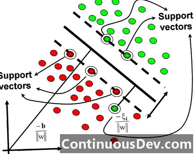 Podpora vektorového stroja (SVM)