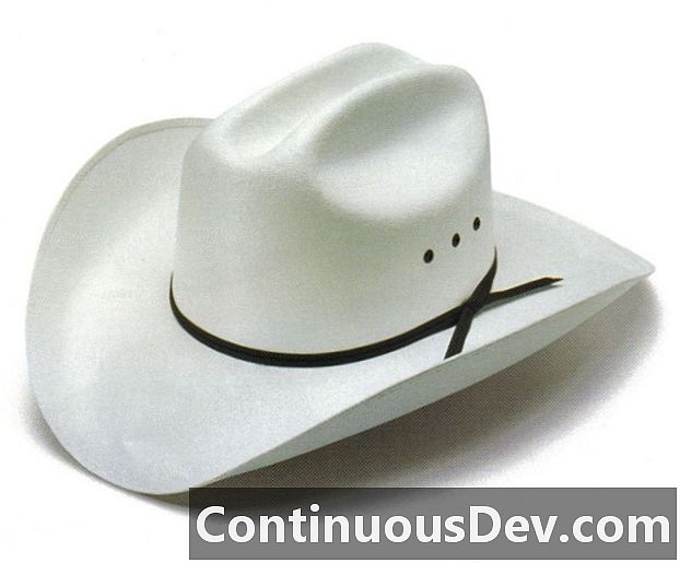 Optimizacija iskalnikov White Hat (White Hat SEO)